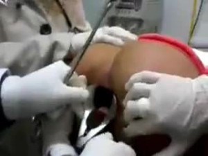 The Lovely Life of a Proctologist