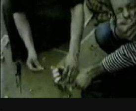 Finger cut off